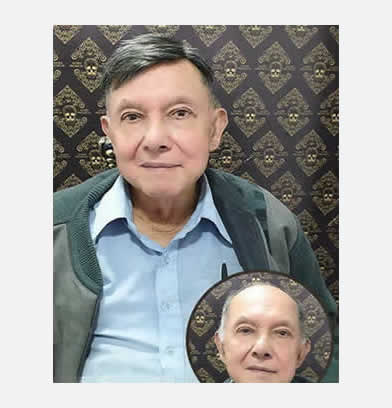 service de pelo
